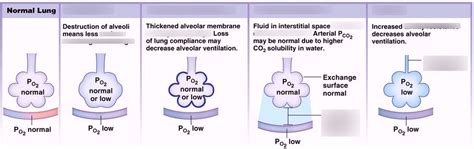 Slides/ Pathologies Causing Hypoxia Diagram | Quizlet