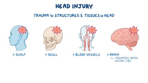 Head injury: Nursing - Osmosis Video Library