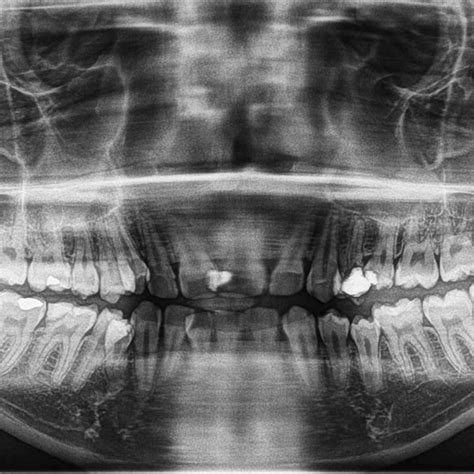 Digital OPG – Skyline Diagnostic