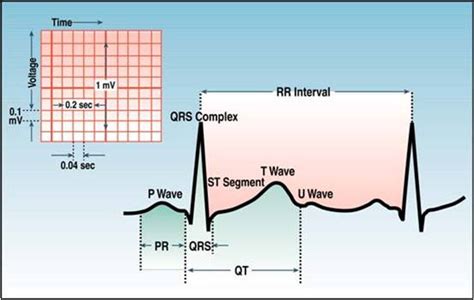 ECG Learning Center - An introduction to clinical electrocardiography