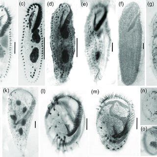 Classification of the phylum Ciliophora (adapted from Adl et al. [24]).... | Download Scientific ...