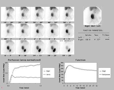 NUCLEAR MEDICINE