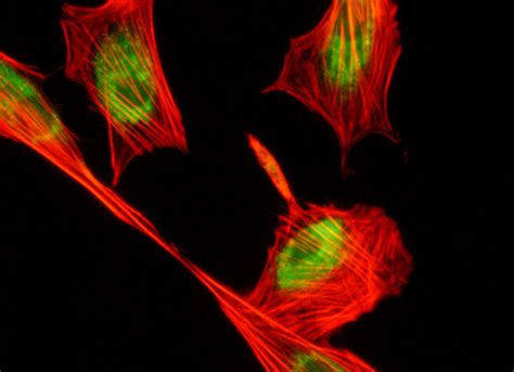 Fibroblasts with Alexa Fluor 568 and LysoTracker DND-26 | Nikon’s ...