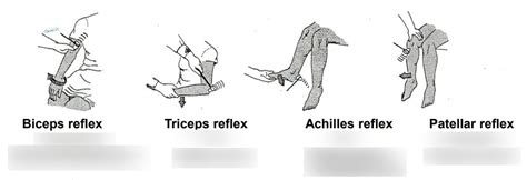 Deep Tendon Reflex Tests Diagram | Quizlet