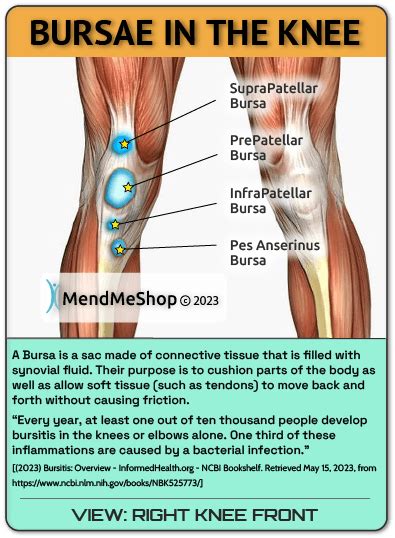 Ice vs Heat for Bursitis?