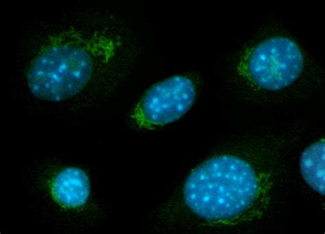 Swiss Mouse (3T3) Cells with DAPI and Alexa Fluor 488 | Nikon’s MicroscopyU