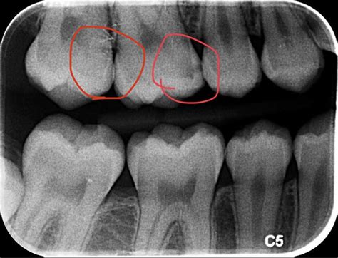 Dental X-Rays at Holistic Dental Associates