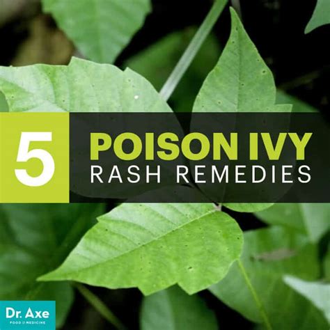 Top 5 Natural Remedies for Poison Ivy Rash | Best Pure Essential Oils