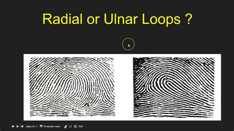 10 Facts About Radial Loop Fingerprints!, 43% OFF