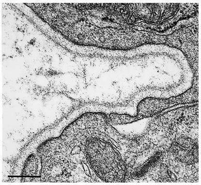 Electron micrograph of basal portion of glandular epithelial cell... | Download Scientific Diagram