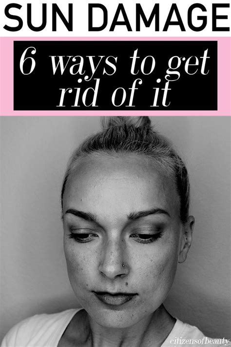 6 ways to prevent and get rid of brown spots citizens of beauty – Artofit