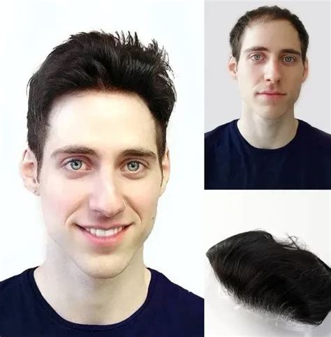 Toupee vs. Wig and How Much Does a Toupee Cost? - Hair System