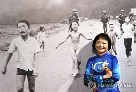 Vietnam War 'Napalm Girl' Completes Burn Treatment after 50 Years ...