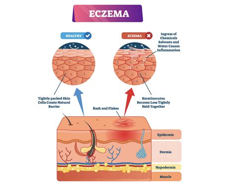 7 Causes of Itchy Skin [Pruritus]: Treatments for Rashes, Bumps & More - Dr. Michelle Jeffries