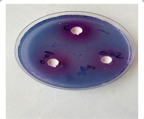 Samples introduced into agar plates and kept for incubation | Download Scientific Diagram