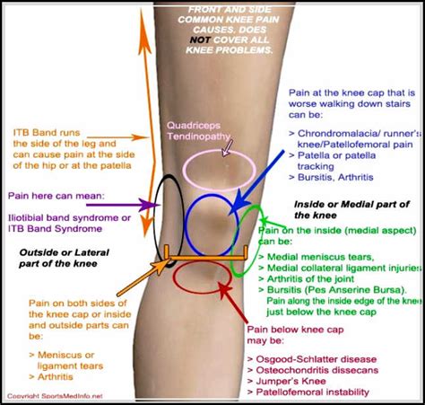 Knee Pain Causes You Should Know and Avoid - Your friendly fashion blog assistant