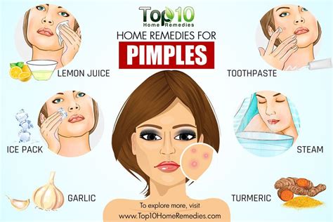 Home Remedies for Pimples | Top 10 Home Remedies