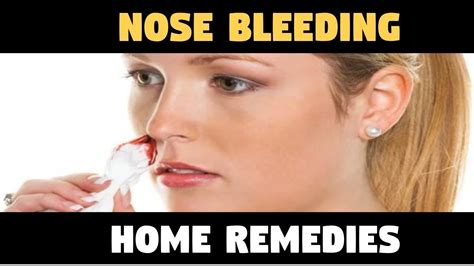 Why NoseBleed – NOSE BLEEDING Home Remedies – Epistaxis – Causes - YouTube