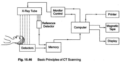 CT Scan Working Principle - EEEGUIDE.COM