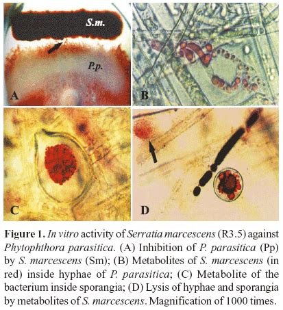 Serratia marcescens - encyclopedia article - Citizendium