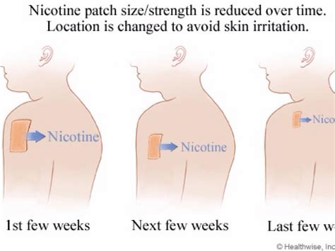 Nicotine Patch by Bailey Griffin