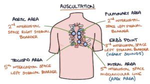 Aortic Regurgitation Murmur