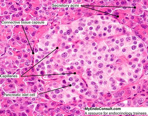 Islet Cells Of The Pancreas - MyEndoConsult