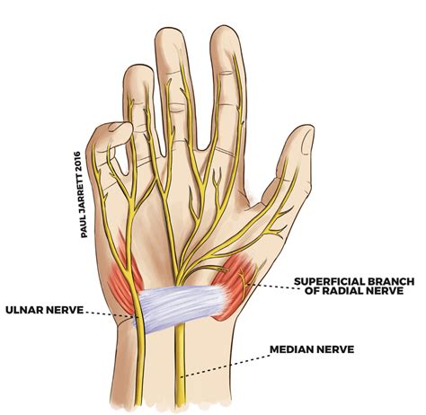 Wrist Anatomy | Metro Wallpapers