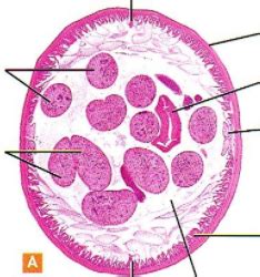 Male Ascaris Cross Section Diagram | Quizlet