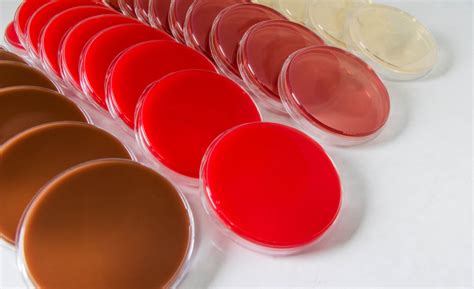 How to Automate the Preparation of Selective Agar Plates