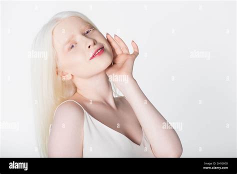 Smiling albino model looking at camera isolated on white Stock Photo - Alamy