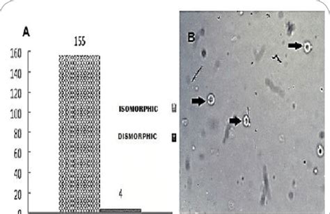 A) Frequency of RBC morphology in urine samples after microscopic... | Download Scientific Diagram