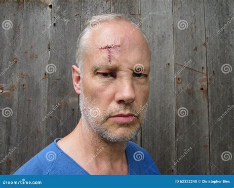 Forehead Scar stock photo. Image of beard, eyes, forehead - 62322240