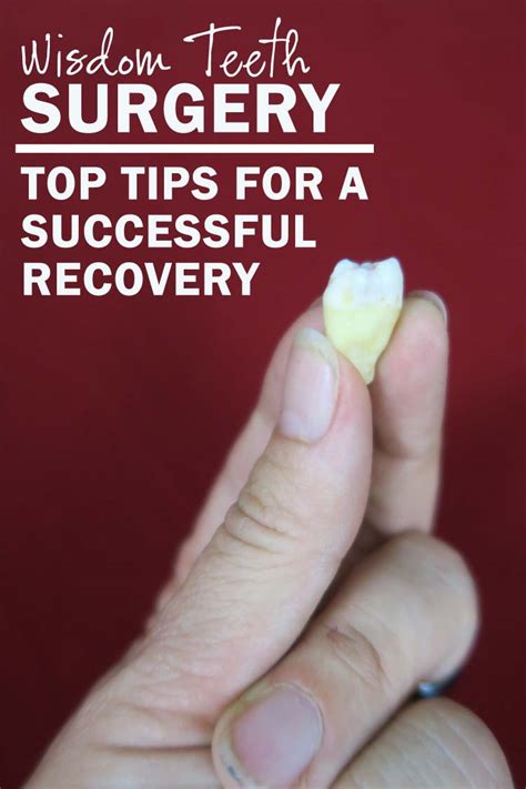 Wisdom teeth surgery, recovery and complications - Di Hickman