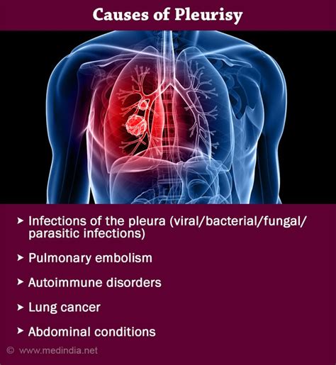 Pleurisy - Causes, Symptoms, Diagnosis, Treatment, Complications, Prognosis & Prevention