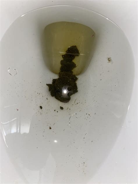 Very Dark green poop/Diarrhea. Stomach gurgling. Should I be worried? : r/ibs