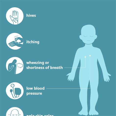 Anaphylaxis: Signs, Symptoms, and Complications