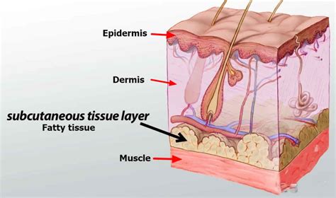 Subcutaneous injection sites, how to give subcutaneous injection & technique