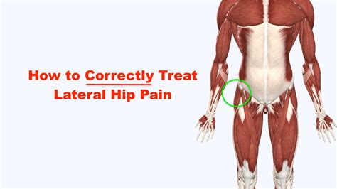 Fixing Lateral Hip Pain – Squat University