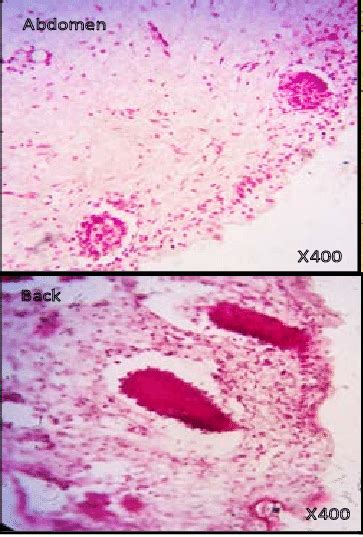 Histology of a 4 months old fetus (H&E). Top left: Tissue from an... | Download Scientific Diagram