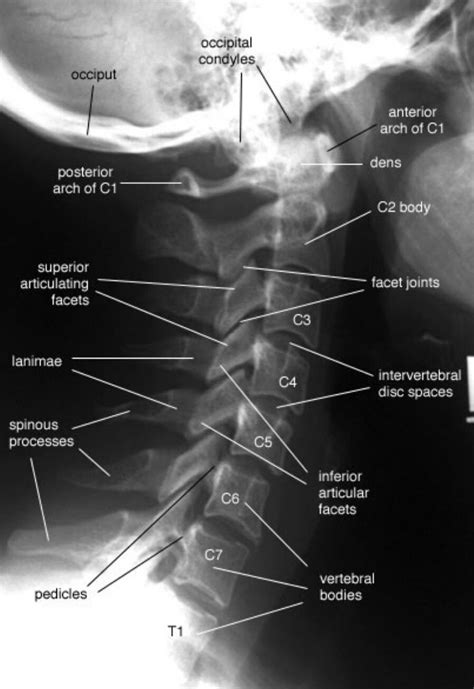 Pin by Kris Lacosta on ANATOMÍA RADIOLÓGICA | Radiology student, Medical anatomy, Diagnostic imaging