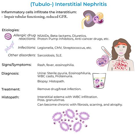 Clinical Pathology Glossary: Acute Tubular Necrosis & Interstitial Nephritis | ditki medical ...