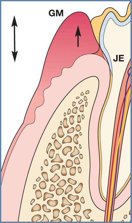 Mucogingival Junction Histology