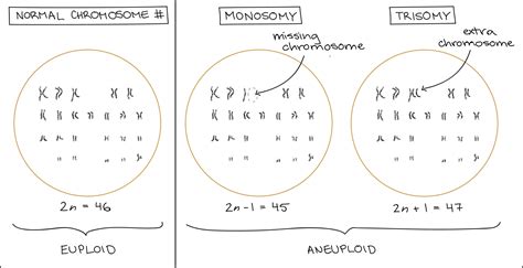 Aneuploidy, fetal aneuploidy, aneuploidy disorders & screening