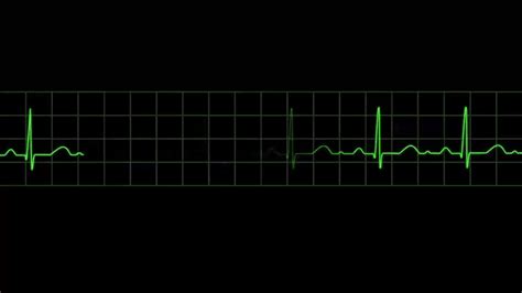 Animated Ecg Eeg Gif