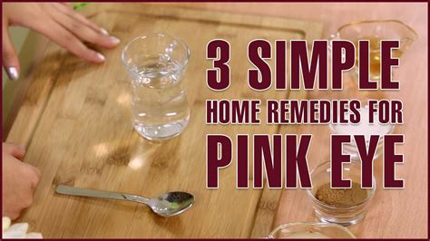 3 Simple Natural Home Remedies For PINK EYE TREATMENT - YouTube