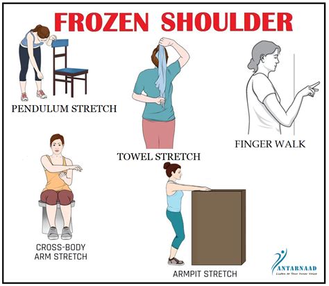 5 Effective Exercises for Frozen Shoulder - Blog