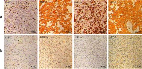 Expression of different biological markers by immunohistochemical... | Download Scientific Diagram