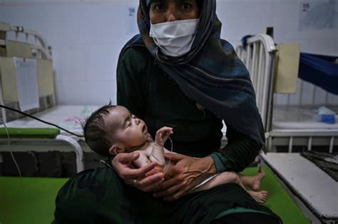 Afghan babies succumb to hunger as winter descends - Digital Journal