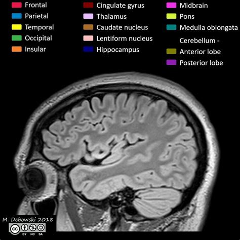 Brain lobes - annotated MRI (Radiopaedia 61691-69700 Sagittal) - NC Commons